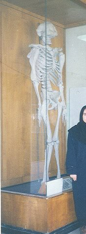 مطالب داغ: عجیب الخلقه ترین مرد ایرانی در تاریخ مطالب داغ: عجیب الخلقه ترین مرد ایرانی در تاریخ