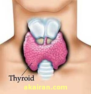 کم کاری تیروئید چیست 1