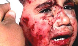 سازمان عفو بین‌الملل: اسرائیل جنایتکار جنگی است قتل عام کشتار زنان کودکان مردان دختران پسران شکنجه زخمی فلسطین حماس غزه