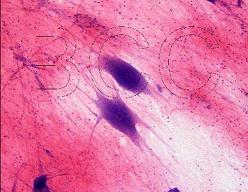 img/daneshnameh_up/b/b3/spinal_cord_nerve_cells_4w.jpg