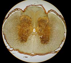 img/daneshnameh_up/a/a1/Spinal_Cord_PC271498.jpg