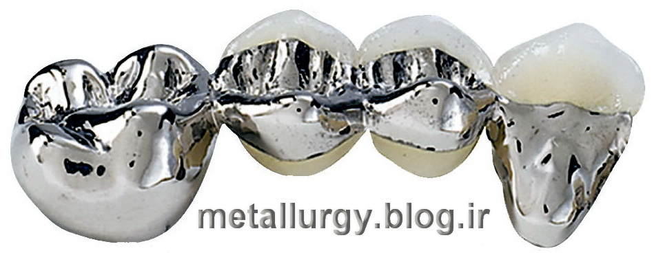 پلادیوم در ساخت دندان و لوازم پزشکی