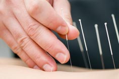 طب سوزنی: نقش طب سوزنی در درمان بیماری ها طب سوزنی: نقش طب سوزنی در درمان بیماری ها
