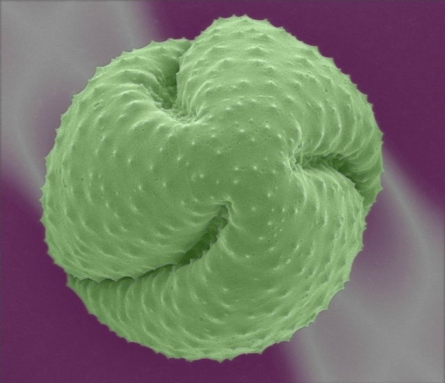 عکس میکروسکوپی باکتری