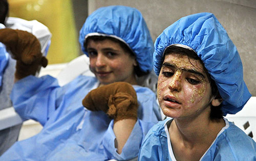 آخرین وضعیت دختران حادثه دیده پیرانشهر (+عکس)